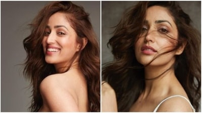 Yami Gautam has a skin condition, keratosis pilaris. Yami Gautam has a skin condition, keratosis pilaris.