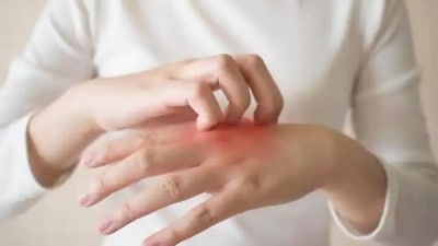 Wearing sweater to sleep increases dryness of skin. This leads to eczema and other skin problems. 
