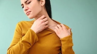 Not just eczema, wearing sweaters to sleep can increase the risk of other skin problems as well. 