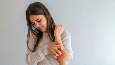 Wearing sweaters can lead to the lint getting attached to the skin - this leads to itching and other skin problems. 