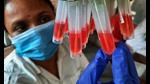 The new, highly mutated Omicron variant of the SARS-CoV-2 is fast replacing the Delta variant in Mumbai health experts said as the city recorded 3,555 fresh cases on Thursday (HT) The new, highly mutated Omicron variant of the SARS-CoV-2 is fast replacing the Delta variant in Mumbai health experts said as the city recorded 3,555 fresh cases on Thursday (HT)