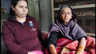Harcharan Kaur, an elderly woman who was assaulted during robbery at her residence in Ludhiana, shows her injury marks. (HT File) Harcharan Kaur, an elderly woman who was assaulted during robbery at her residence in Ludhiana, shows her injury marks. (HT File)
