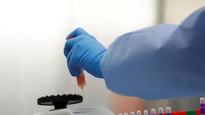 Some of the Pune hospitals which started using Molnupiravir on Covid patients have reported what they claim to be “good results”. (REUTERS (PIC FOR REPRESENTATION)) Some of the Pune hospitals which started using Molnupiravir on Covid patients have reported what they claim to be “good results”. (REUTERS (PIC FOR REPRESENTATION))