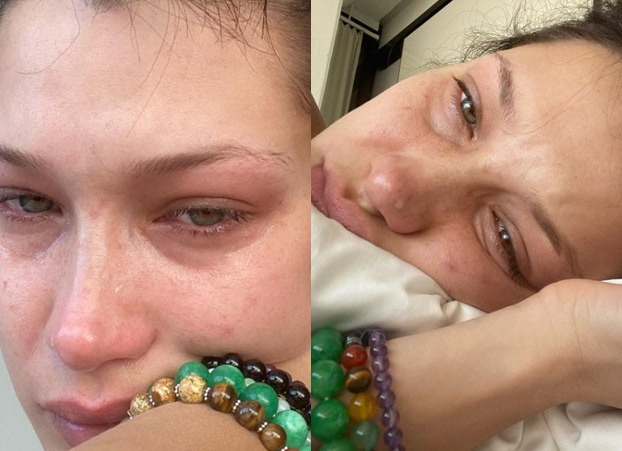 Bella Hadid proud of herself after recovering, posts pics of health  struggle : The Tribune India