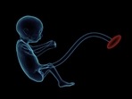 In vitro fertilization: 12 questions to ask before beginning an IVF treatment (Pixabay) In vitro fertilization: 12 questions to ask before beginning an IVF treatment (Pixabay)