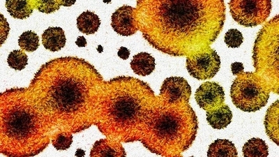 Superbug is a strain of bacteria that has become resistant to antibiotic drugs. (Representative Photo/Shutterstock)