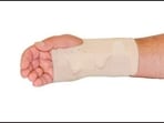 Study finds metal pins no better than plaster cast for broken wrists