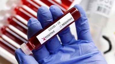The study focused on 52 households where people were living with those who tested positive for Covid-19. (Representative image)