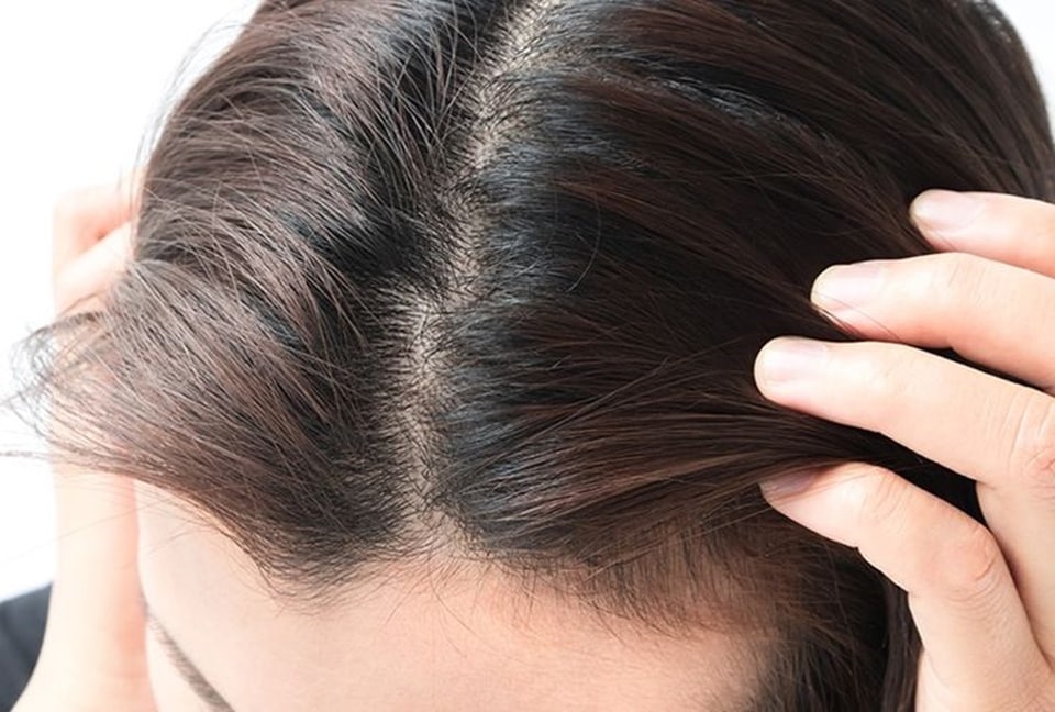 bike helmet folliculitis Melon Bicycle Urban Active Dotty White  Melon World GmbH How Women Cyclists Can Prevent