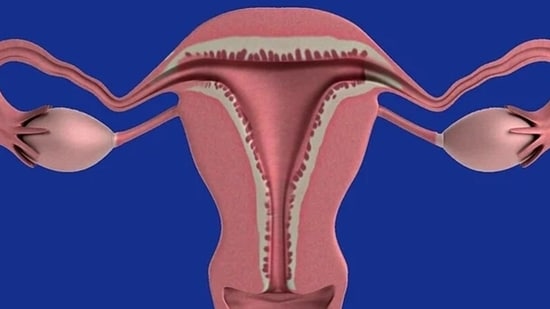 Ovarian cancer refers to any cancerous growth that begins in the ovary.(Pixabay)