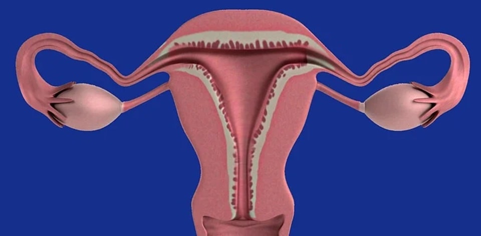 Ovarian cancer refers to any cancerous growth that begins in the ovary. (Pixabay)