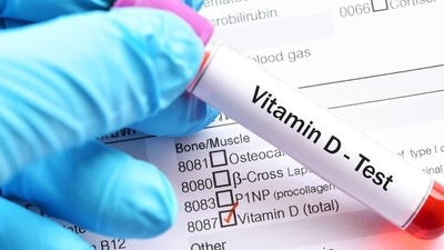 Study links Vitamin D deficiency to deaths among hospitalized Covid-19 patients (Stock Photo) Study links Vitamin D deficiency to deaths among hospitalized Covid-19 patients (Stock Photo)
