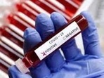 Daily infections peaked at 28,867 on January 13, while the test positivity rate hit a fifth-wave high of 30.64% a day later. (Picture for representation only/HT) Daily infections peaked at 28,867 on January 13, while the test positivity rate hit a fifth-wave high of 30.64% a day later. (Picture for representation only/HT)