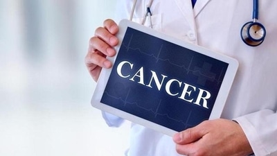 Can moderate exercise program improve cancer treatment outcomes? Here's what study says (Shutterstock) Can moderate exercise program improve cancer treatment outcomes? Here's what study says (Shutterstock)