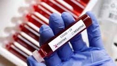 Daily infections peaked at 28,867 on January 13, while the test positivity rate hit a fifth-wave high of 30.64% a day later. (Picture for representation only/HT) Daily infections peaked at 28,867 on January 13, while the test positivity rate hit a fifth-wave high of 30.64% a day later. (Picture for representation only/HT)