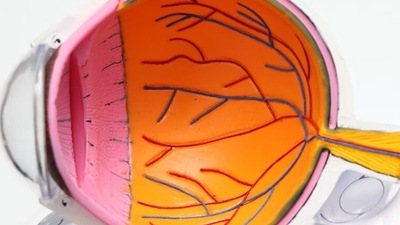 Diabetic retinopathy: If you have type-1 or type-2 diabetes, it’s important to have your eyes examined every year to check diabetic retinopathy. High blood sugar and hypertension take a toll on the tiny blood vessels that lead to your retina. 