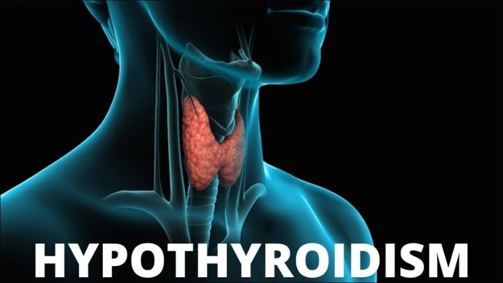Thyroid: Diet, foods to avoid and 7 best natural supplements for hypothyroidism | Health