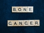Bone cancer(Pexels) Bone cancer(Pexels)