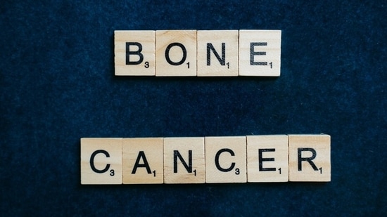 Bone cancer(Pexels)