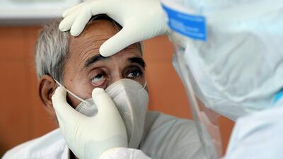 A doctor examines a COVID-19 patient for black fungus infection. (FILE PHOTO) A doctor examines a COVID-19 patient for black fungus infection. (FILE PHOTO)
