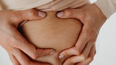 Treat stretch marks: Argan oil has been used to reduce and prevent stretch marks. There is currently no scientific study to back this claim but it has been considered to be effective since it contains Vitamin E, an ingredient that helps in improving elasticity in the skin. (Unsplash) Treat stretch marks: Argan oil has been used to reduce and prevent stretch marks. There is currently no scientific study to back this claim but it has been considered to be effective since it contains Vitamin E, an ingredient that helps in improving elasticity in the skin. (Unsplash)
