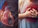 Foods and drinks that cause sudden cardiac arrest (Twitter/Eqraaam) Foods and drinks that cause sudden cardiac arrest (Twitter/Eqraaam)