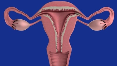 Ovarian cancer: Women should watch out for these warning signs (Pixabay) Ovarian cancer: Women should watch out for these warning signs (Pixabay)