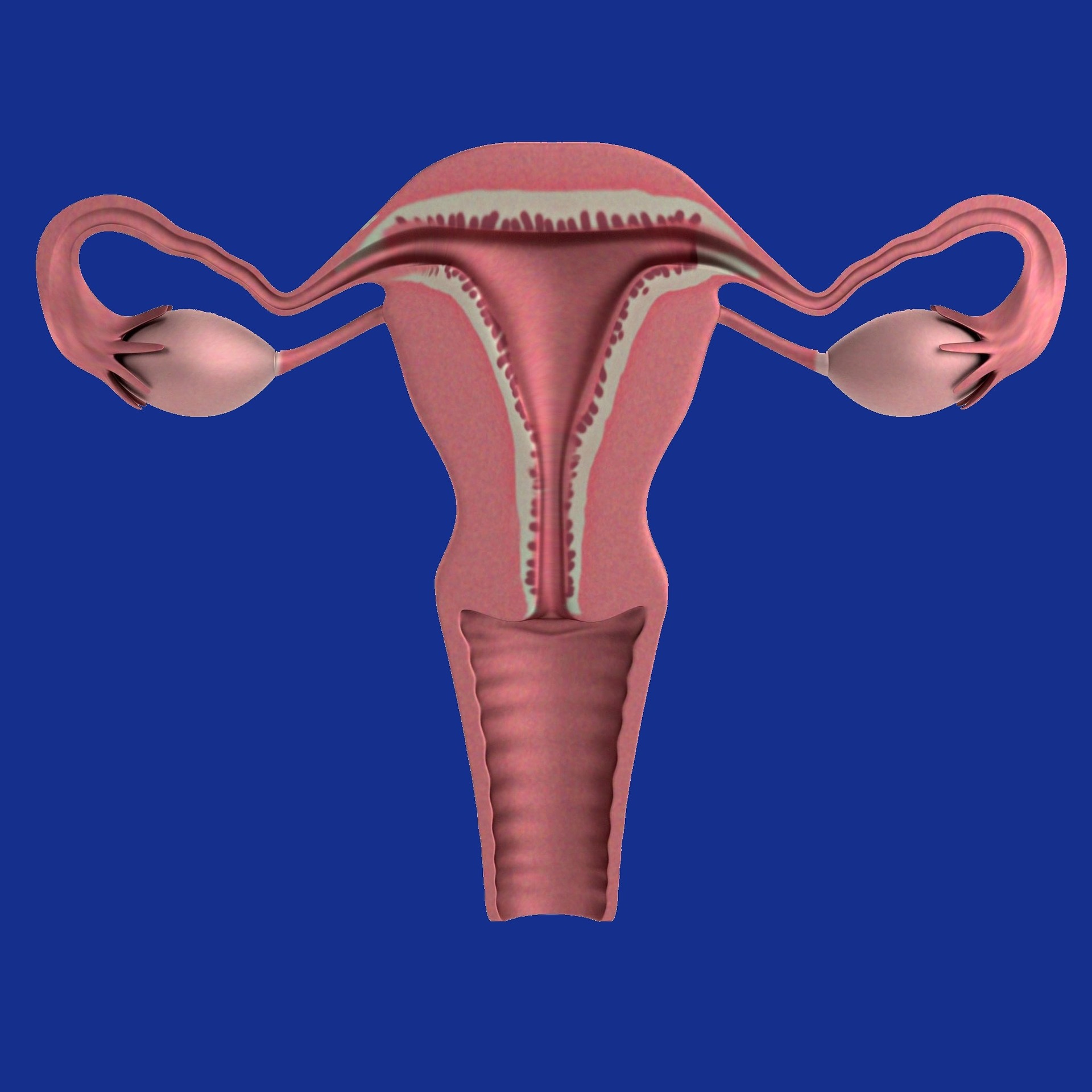 Ovarian cancer does not behave like most cancers people are taught to fear. (Pixabay)