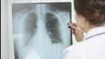 The civic body will be using the Extension for Community Healthcare Outcomes (ECHO) platform for the virtual clinic. (StockPic) The civic body will be using the Extension for Community Healthcare Outcomes (ECHO) platform for the virtual clinic. (StockPic)