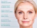 Wrinkle-smoothening patches are effective in reducing aging issues such as wrinkles and fine lines.&nbsp;