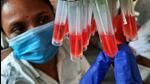 While the daily total vaccination doses administered at BMC-run vaccination centres is around 20,000 to 30,000, the number stands between 1500-3000 at private hospitals. (Praful Gangurde / HT Photo) While the daily total vaccination doses administered at BMC-run vaccination centres is around 20,000 to 30,000, the number stands between 1500-3000 at private hospitals. (Praful Gangurde / HT Photo)