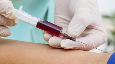 Haemophilia is a genetic bleeding disorder that causes bleeding for a long time after injury or surgery. It is caused by the absence of clotting factors VIII and IX in the blood that results in increased bleeding. (Getty Images/iStockphoto)