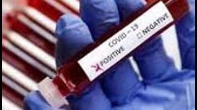 Tricity now has 173 active Covid cases, of which 71 are in Chandigarh, 66 in Mohali and 36 in Panchkula. (HT File)