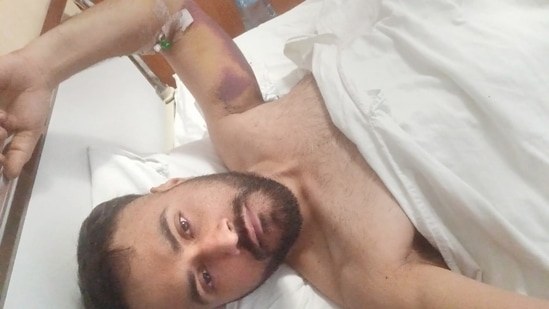 Indian student Harjot Singh who was shot multiple times while trying to escape from Ukraine capital Kyiv.(PTI) Indian student Harjot Singh who was shot multiple times while trying to escape from Ukraine capital Kyiv.(PTI)