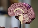 Covid Can Shrink the Brain as Much as a Decade of Aging, Study FindsCovid Can Shrink the Brain as Much as a Decade of Aging, Study Finds