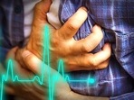 Heart attack plus cardiac arrest survivors at higher risk of early death