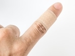 New study sheds light on how blood clots are formed during wound healing