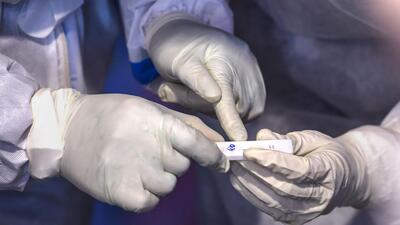 There are 33 active Covid cases in the district, of which 32 are under home isolation,and one patient is undergoing treatment at a government facility. (PTI) There are 33 active Covid cases in the district, of which 32 are under home isolation,and one patient is undergoing treatment at a government facility. (PTI)