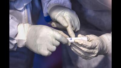 Jammu and Kashmir had registered a death related to the virus on March 4. A Covid-19 related death was recorded in Jammu and Kashmir after eight days on Sunday. (PTI File Photo/ Representational image)