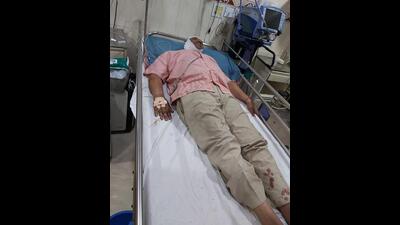 Traffic constable Nagnath Kande being treated at a hospital in Thane on Friday. He was attacked by a drunken person with a stone. The attacker was arrested. (HT PHOTO)