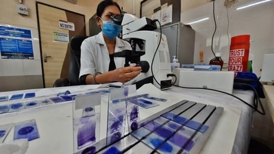 A pathologist testing tuberculosis samples in Thane. Many tuberculosis cases go undiagnosed during the pandemic in Thane, say experts. (PRAFUL GANGURDE/HT PHOTO) A pathologist testing tuberculosis samples in Thane. Many tuberculosis cases go undiagnosed during the pandemic in Thane, say experts. (PRAFUL GANGURDE/HT PHOTO)