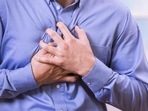 Chest pain is the hallmark presentation of myocardial infarction