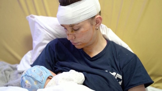 Olga, a 27-year-old Ukrainian woman who was seriously injured while protecting her baby from shell blasts amid the Russian invasion of Ukraine, holds her baby Victoria in Kyiv, Ukraine.  (via Reuters)