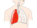 World Tuberculosis Day: Check out these 5 Yoga exercises to control TB symptoms World Tuberculosis Day: Check out these 5 Yoga exercises to control TB symptoms 