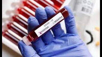 With 34 persons recovering from the Covid, the number of cured persons in the state has reached 7,41,130 in Punjab.