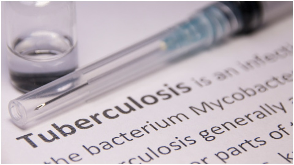 TB has been one of the biggest public health challenges in India. However, India is committed to end TB by 2025 — ahead of the year 2030 — the target set under the SDGs.&nbsp; (Unsplash)
