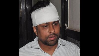 Injured junior engineer Rohit Saini at Panchkula civil hospital after on Friday. (Sant Arora/HT) Injured junior engineer Rohit Saini at Panchkula civil hospital after on Friday. (Sant Arora/HT)