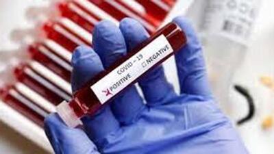 With the rise in daily case count, there was no change in Chandigarh tricity area’s active Covid caseload, which stands at 38. (HT File)