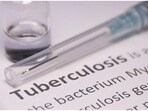 World Tuberculosis Day: Expert offers insights on causes and prevention of TB(Unsplash)