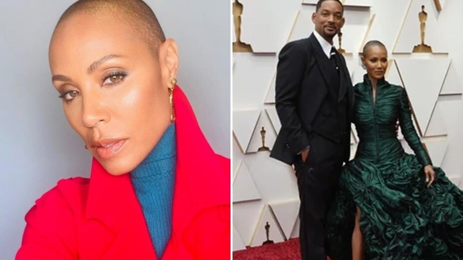 What is alopecia, the hair loss condition Jada Pinkett Smith suffers from?  | Health - Hindustan Times